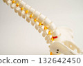 Spinal nerve and bone, Lumbar spine displaced herniated disc fragment, Model for treatment medical in the orthopedic department. 132642450