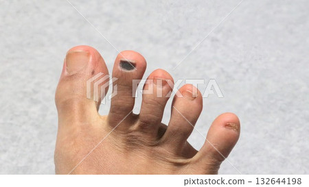Person with toes spread Person with toes spread 132644198