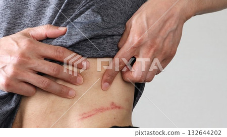 Person pointing to injury on side 132644202