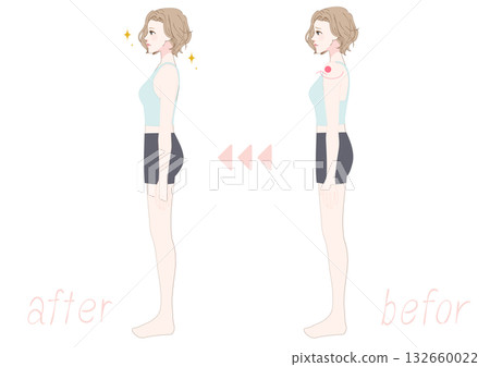 一位女士側臥矯正圓肩，前後對比圖 132660022