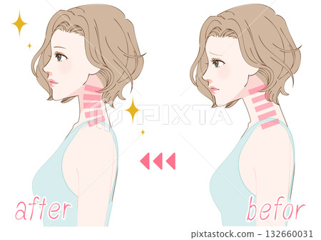 一位女性調整直頸前後的比較照片 一位女性調整直頸前後的比較照片 132660031