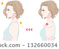 Before and after profile of a woman adjusting her rounded shoulders 132660034