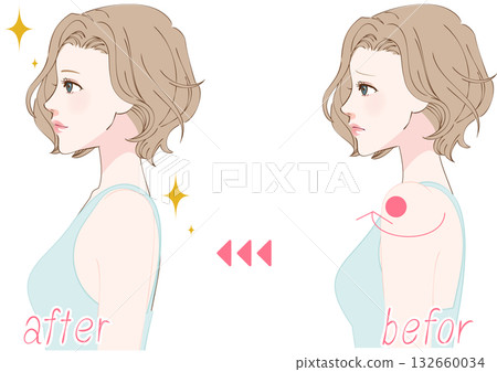 Before and after profile of a woman adjusting her rounded shoulders 132660034