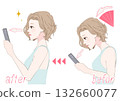 Before and after of a woman's profile after improving her smartphone neck 132660077
