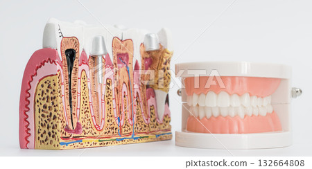 Tooth Cross-Section Model and Full Dental Denture Tooth Cross-Section Model and Full Dental Denture 132664808