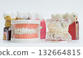 Assorted Dental Education Models with Dentures and Implants 132664815
