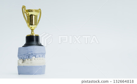 Dental Trophy Displayed on Plaster Cast Model Dental Trophy Displayed on Plaster Cast Model 132664818