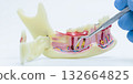 Dental Training Model with Tool Demonstration 132664825