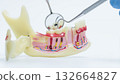 Dental Tools Examining Tooth Decay on Model 132664827