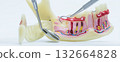 Dental Demonstration Using Jaw Anatomy Model 132664828