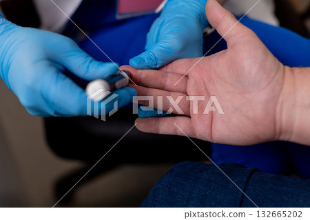 A Medical Examination of the Patients Hand is vital for accurate assessment of their condition 132665202