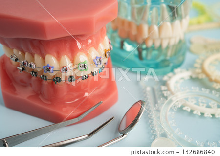 Orthodontic ligatures rings and ties, elastic rubber bands on orthodontic braces, model for dentist studying about dentistry. Orthodontic ligatures rings and ties, elastic rubber bands on orthodontic braces, model for dentist studying about dentistry. 132686840