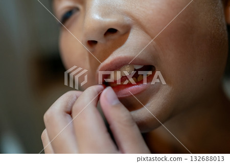 箍牙 牙齒 齒輪 132688013
