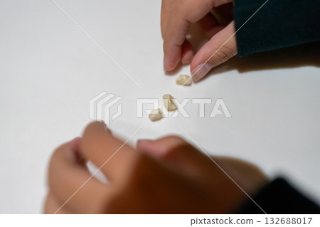 箍牙 牙齒 齒輪 132688017