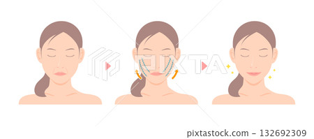 線雕提升治療細節及效果向量圖 132692309