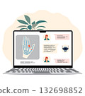 Online medical consultation concept with x-ray and chat on laptop screen 132698852