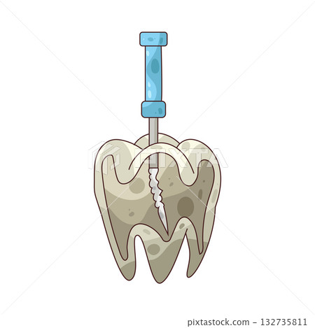 illustration of Root Canal illustration of Root Canal 132735811