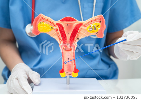 Doctor holding human uterus model for vaginal and cervix pap smear check up in the obstetrics and gynecology. Doctor holding human uterus model for vaginal and cervix pap smear check up in the obstetrics and gynecology. 132736055