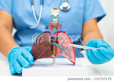 Cirrhosis, Liver cancer, fatty liver, Asian woman with liver human anatomy model. Cirrhosis, Liver cancer, fatty liver, Asian woman with liver human anatomy model. 132747279