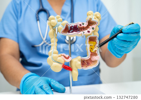 Intestine, Asian woman holding human anatomy model. 132747280