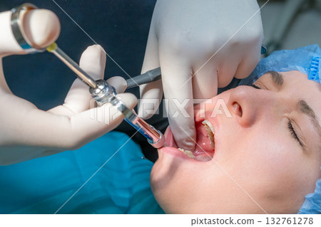 Dentist administers local anesthetic injection into patient gums. Woman wearing blue surgical cap with mouth open during preparation for procedure 132761278