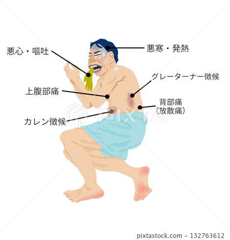 基於全身症狀的急性胰臟炎插圖（男性/醫學和護理教學材料） 132763612