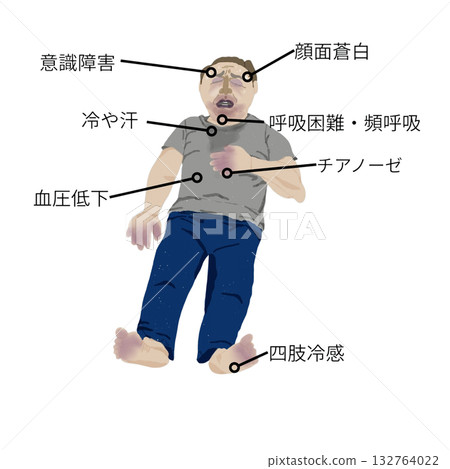 心因性休克症狀圖示（護理和醫學教學材料） 132764022