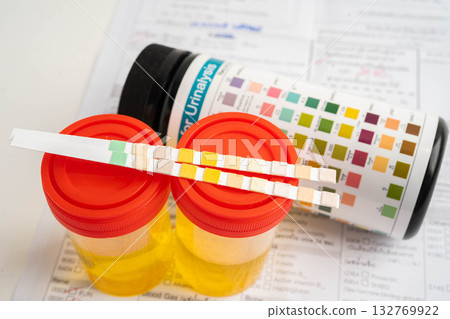 Urinalysis, urine cup with reagent strip pH paper test and comparison chart in laboratory. Urinalysis, urine cup with reagent strip pH paper test and comparison chart in laboratory. 132769922