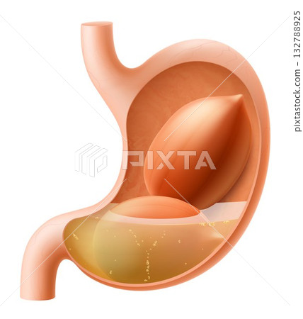 Human Stomach with peanuts. The stomach digests peanut. A stomach filled with healthy and wholesome food. Proper nutrition. Realistic 3d Vector illustration. Food digestion process illustration 132788925