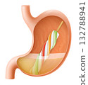 Human Stomach with popsicle ice cream. The stomach digests ice cream. A stomach with Ice cream frozen juice on stick. Delicious sweet food. Realistic 3d Vector illustration. Food digestion process. 132788941