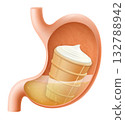 Human Stomach with vanilla ice cream in a waffle cup. The stomach digests ice cream. A stomach filled with delicious sweet food. Realistic 3d Vector illustration. Food digestion process. 132788942