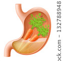 Human Stomach with carrot. The stomach digests carrots. A stomach filled with healthy and wholesome food. Proper nutrition. Realistic 3d Vector illustration. Food digestion process illustration 132788948