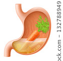 Human Stomach with carrot. The stomach digests carrots. A stomach filled with healthy and wholesome food. Proper nutrition. Realistic 3d Vector illustration. Food digestion process illustration 132788949