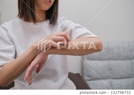 特寫鏡頭顯示一名女子手臂周圍皮膚搔癢,原因是皮膚炎、昆蟲叮咬和過敏症狀。 特寫鏡頭顯示一名女子手臂周圍皮膚搔癢,原因是皮膚炎、昆蟲叮咬和過敏症狀。 132796732