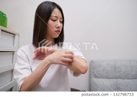 Woman with itchy arm due to dermatitis, insect bites, and allergies 132796733