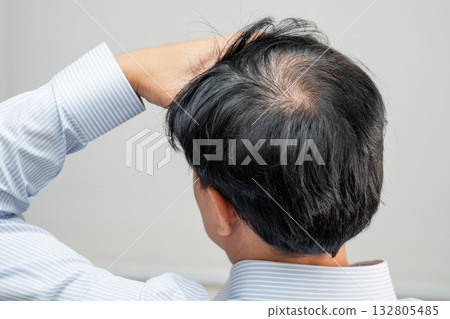 Bald in the middle head and begin no loss hair glabrous of mature Asian business smart active office man. Bald in the middle head and begin no loss hair glabrous of mature Asian business smart active office man. 132805485