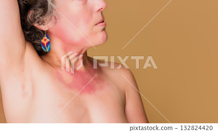 Middle aged woman accepting skin condition, feeling positive body image 132824420