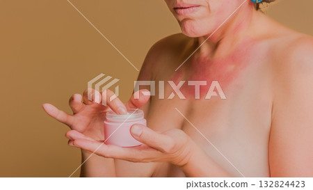 Woman with skin condition applying cream to chest Woman with skin condition applying cream to chest 132824423