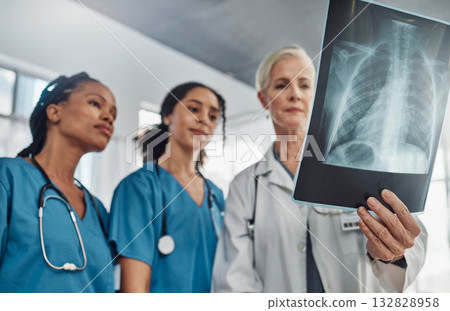 Xray, doctor and nurses, team and medicine with analysis of lung scan and cardiology medical group. Surgeon, collaboration and results with healthcare, focus with health and prepare for surgery 132828958