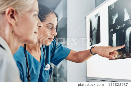 Medical, x ray and surgery with doctors planning in meeting for leg scan, strategy or research. Medicine, consulting and radiology image with healthcare surgeons for diagnosis, treatment or operation Medical, x ray and surgery with doctors planning in meeting for leg scan, strategy or research. Medicine, consulting and radiology image with healthcare surgeons for diagnosis, treatment or operation 132828987