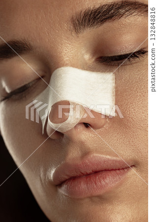 Close up of woman face after nasal correction procedure with bandage on nose resting calmly. 132848816