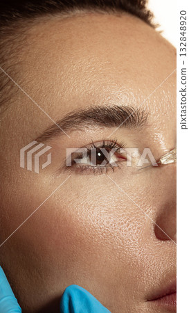 Periocular injection procedure with precision needle near lower eyelid Periocular injection procedure with precision needle near lower eyelid 132848920