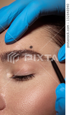 Eyebrow contour marking before correction in aesthetic dermatology procedure. 132848940