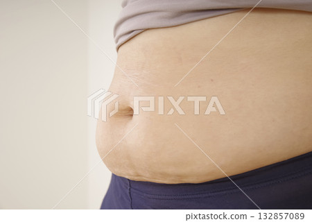 Middle-aged women's bulging belly and subcutaneous fat Middle-aged women's bulging belly and subcutaneous fat 132857089