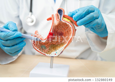 Stomach disease, doctor holding anatomy model for study diagnosis and treatment in hospital. 132860149