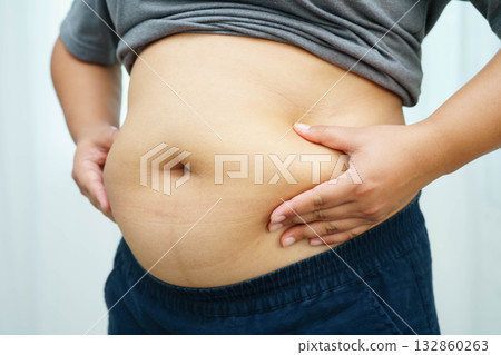 Asian woman use hand to squeeze fat belly big size overweight and obesity. 132860263