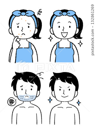 Acne improvement, beard hair removal Acne improvement, beard hair removal 132861269