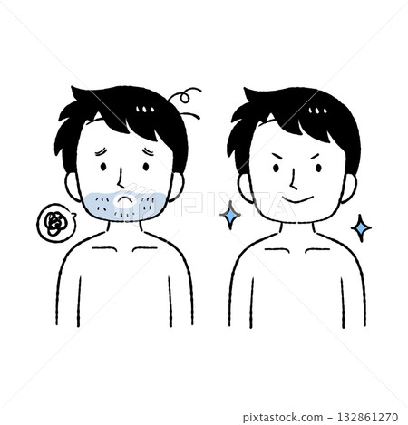 Beard hair removal 132861270