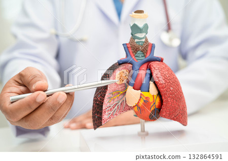 Pneumonia, lung cancer, Asian doctor holding human anatomy model for study diagnosis and treatment in hospital. 132864591
