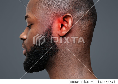 Side view of afro man with inflamed ear, close up 132872731